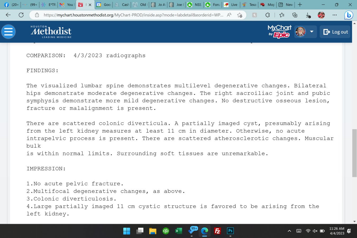 Click image for larger version

Name:	Screenshot (1309).png
Views:	96
Size:	332.1 KB
ID:	1321